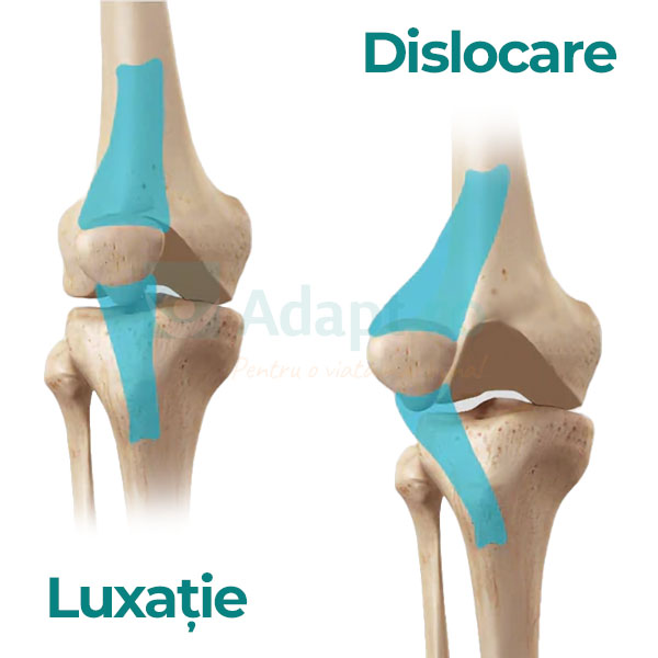Ghid complet orteză de genunchi pentru copii: Tot ce trebuie să știi pentru o recuperare rapidă și sigură